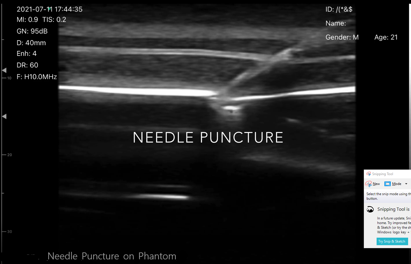 Needle Puncture On Phantom 1